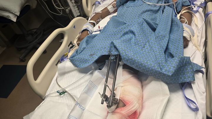 Help Our Sister After Tragic Accident campaign photo, 1 of 8