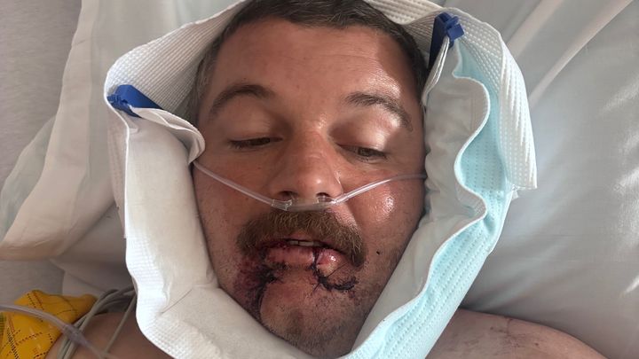 Daniel’s Road to Recovery After Hit-and-Run campaign photo, 1 of 7