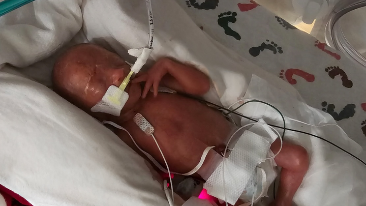 Support Baby Hudson's NICU Journey campaign photo, 1 of 3