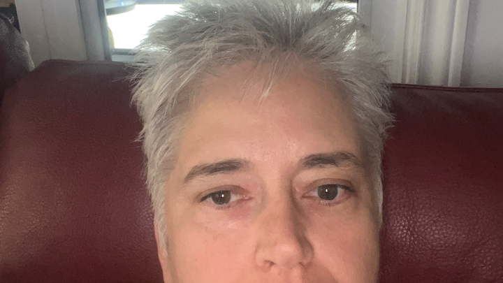 Chirurgie d urgence pour mon fémur droit campaign photo, 1 of 5