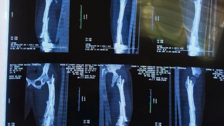 Main fundraiser photo