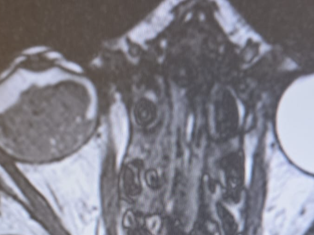 Fundraiser’s main image