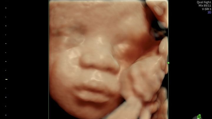 Support Lovely's Birth and Recovery campaign photo, 1 of 7
