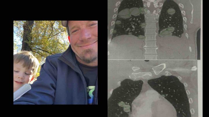 Justin’s medical expenses campaign photo, 1 of 2