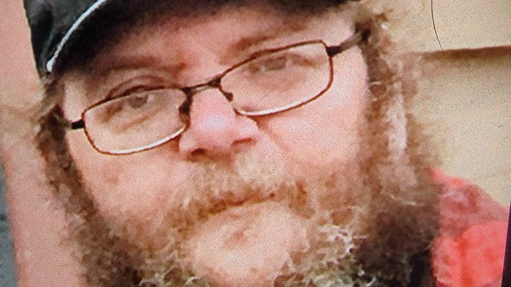 Help Shawn "Mushroom" Conner Crush Cancer!! campaign photo, 1 of 3