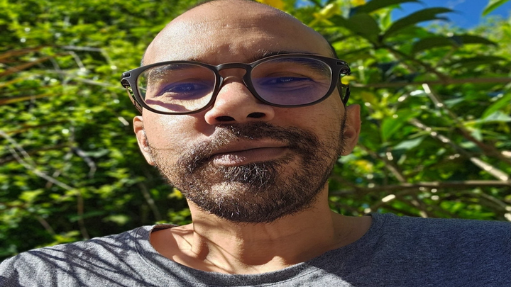 Life saving surgery for Miguel's rare condition campaign photo, 1 of 6
