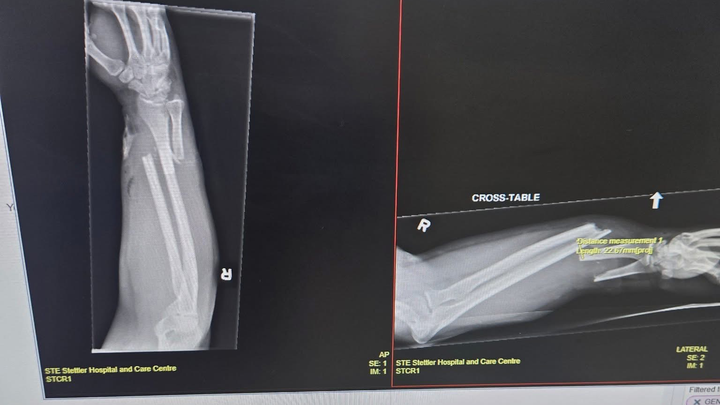 Help my friend Brittany who took the bite to save Corgi Nova campaign photo, 1 of 7