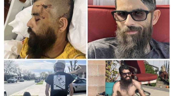 Eric's journey back from a traumatic brain injury campaign photo, 1 of 3