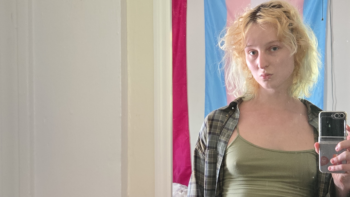 Kassi's Surgery Fund campaign photo, 1 of 3