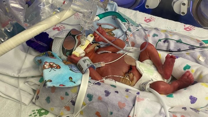 Fundraiser by Fight Like Peter : Post NICU treatment for Peter Collins