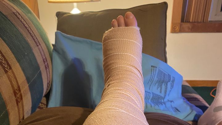 Support Elton’s Recovery After Injury campaign photo, 1 of 5