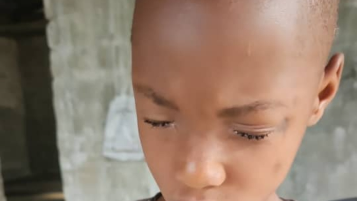 Trachoma risk campaign photo, 1 of 8