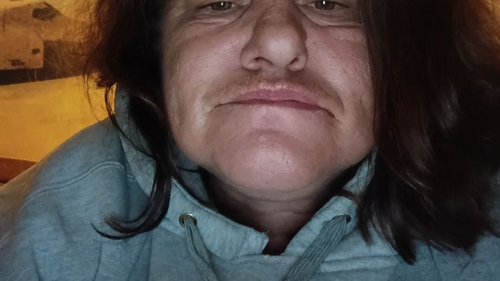 Help Kathryn Get Dental Implants campaign photo, 1 of 5