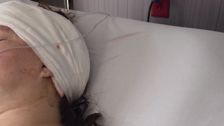 Support Dee’s Recovery After Brain Surgery campaign photo, 1 of 8