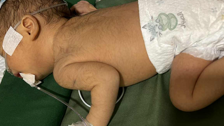 Help Baby Chashi Fight Heart Condition & Hospital Bills campaign photo, 1 of 3
