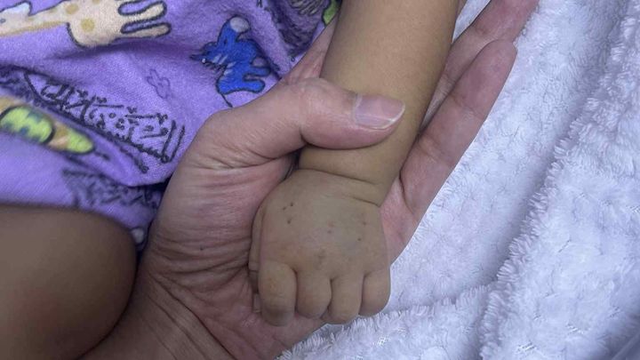 Help Save Baby Jah Christ’s Life: Urgent Lives Surgery Neded campaign photo, 1 of 8