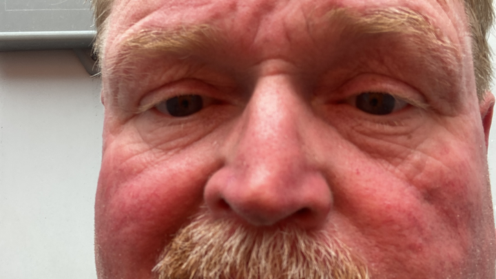Donate to Eric's Healing and Survival Fund campaign photo, 1 of 8