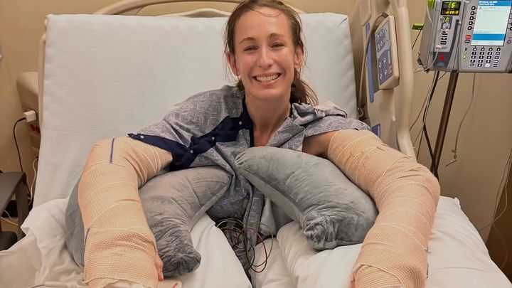 Help Liz Rebuild After a Dog Attack campaign photo, 1 of 6