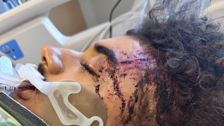 Support Spencer's Recovery After Devastating Crash campaign photo, 1 of 6