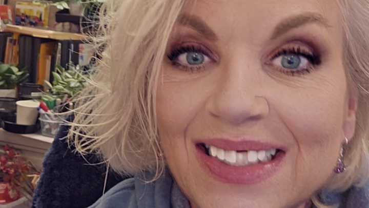 Donate to Help Jill Overcome Her Dental Challenge campaign photo, 1 of 3