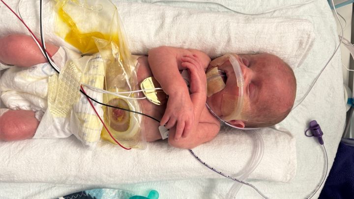 Fundraiser for Jacob Bowers by Kathy Bowers : Support Jacob and Family ...