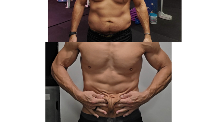 Victor's skin removal surgery campaign photo, 1 of 7