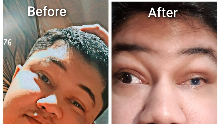 Please Help Me Save My Vision After a Medical Accident campaign photo, 1 of 8