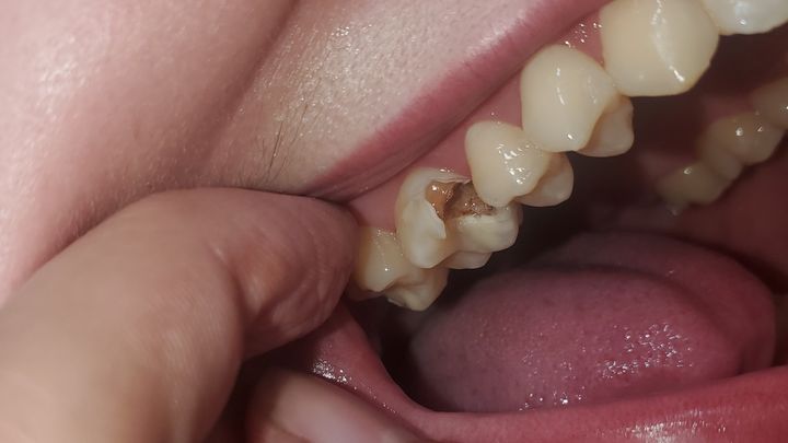 Save Nanah's tooth! (And Housing!!!) campaign photo, 1 of 3