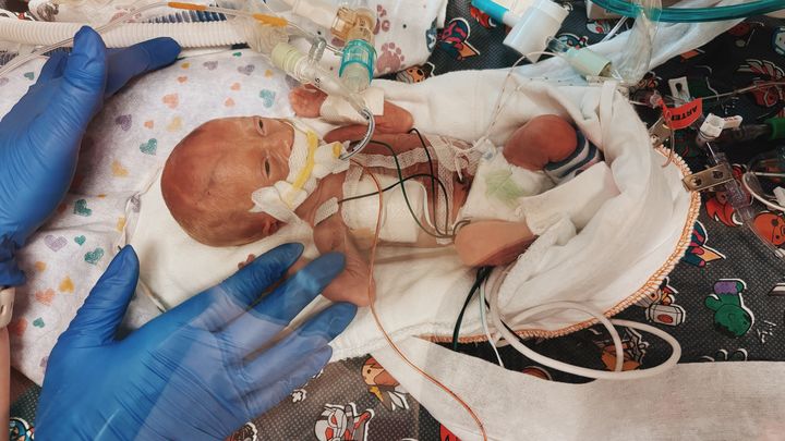Tiny but Mighty: Support Baby Leonardo Chudo’s NICU Journey campaign photo, 1 of 8