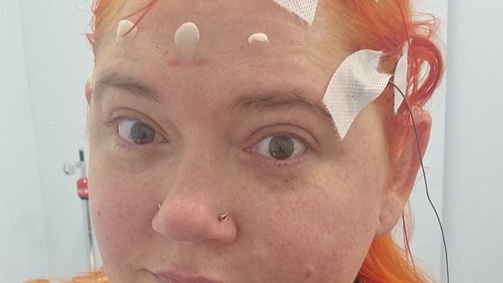 Help With Surgery & Recovery Expenses campaign photo, 1 of 7