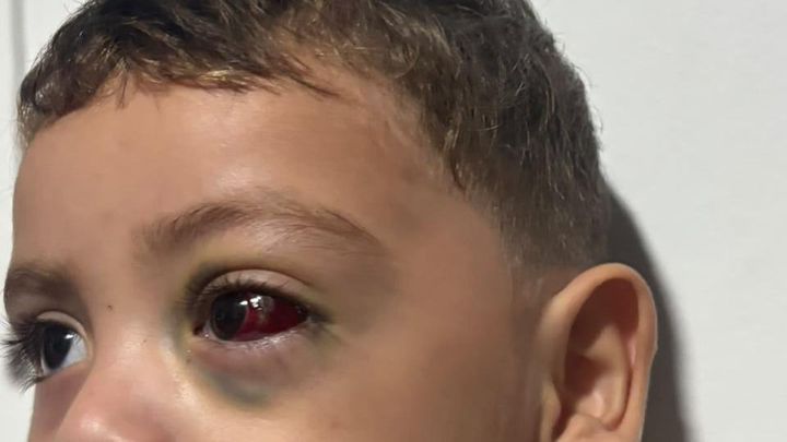 Hope for Liam’s Tests, surgery & Care in Mérida campaign photo, 1 of 7