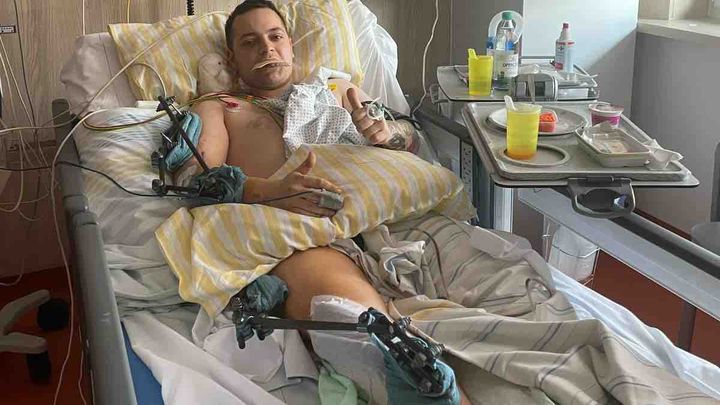 Dringende Hilfe nach schwerem Motorradunfall – Handgas-Umbau campaign photo, 1 of 6