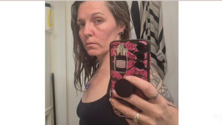 Breast augmentation to feel like the woman I am. Please read campaign photo, 1 of 3