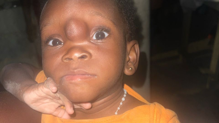 A Support For Mary to Undergo a Surgery campaign photo, 1 of 3