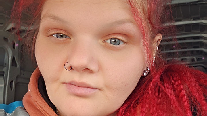 Support Savanna's Fight Against Brain Aneurysms campaign photo, 1 of 4