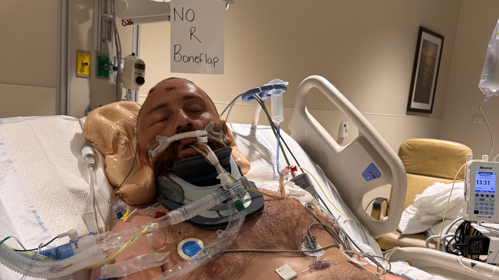 Help Dana Scarberry in his recovery and rebuilding his life campaign photo, 1 of 8