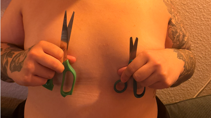 Help please! Donations for TOP operation! FTM mastectomy campaign photo, 1 of 3