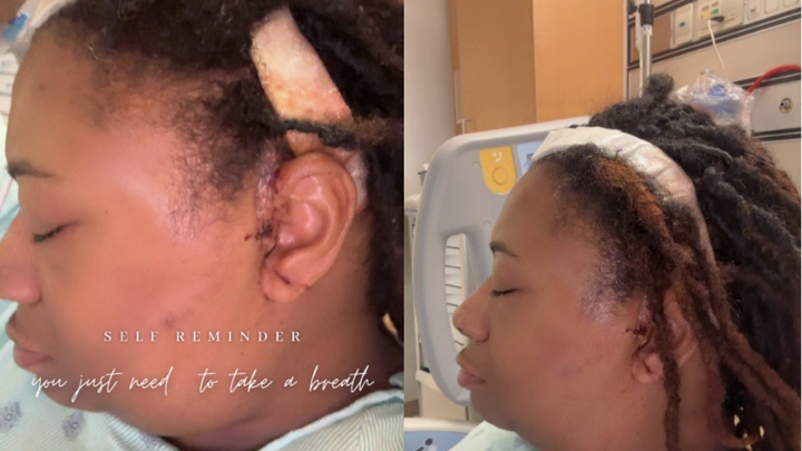 Aid Keshea's Journey Through Brain Tumor Treatment campaign photo, 1 of 5