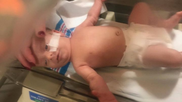 Baby Nickolas' Medical Fund campaign photo, 1 of 3