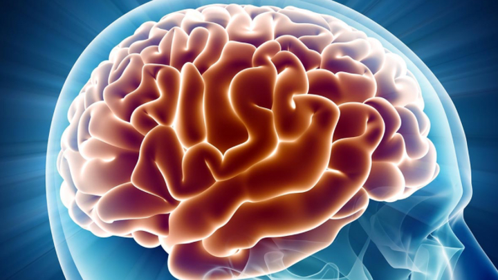 Help Brains out campaign photo, 1 of 3