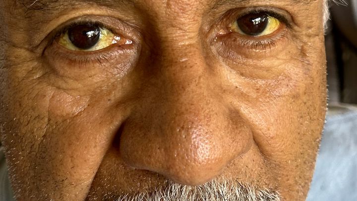 Support Fernando Rodriguez's Medical Journey campaign photo, 1 of 4