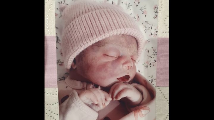 Precious Baby Zoe campaign photo, 1 of 3