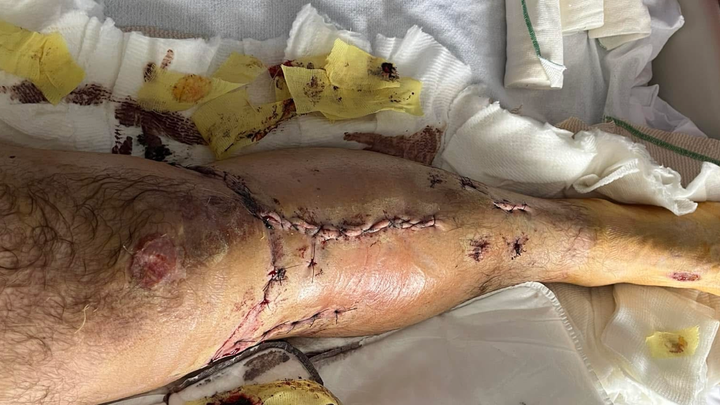 Main fundraiser photo