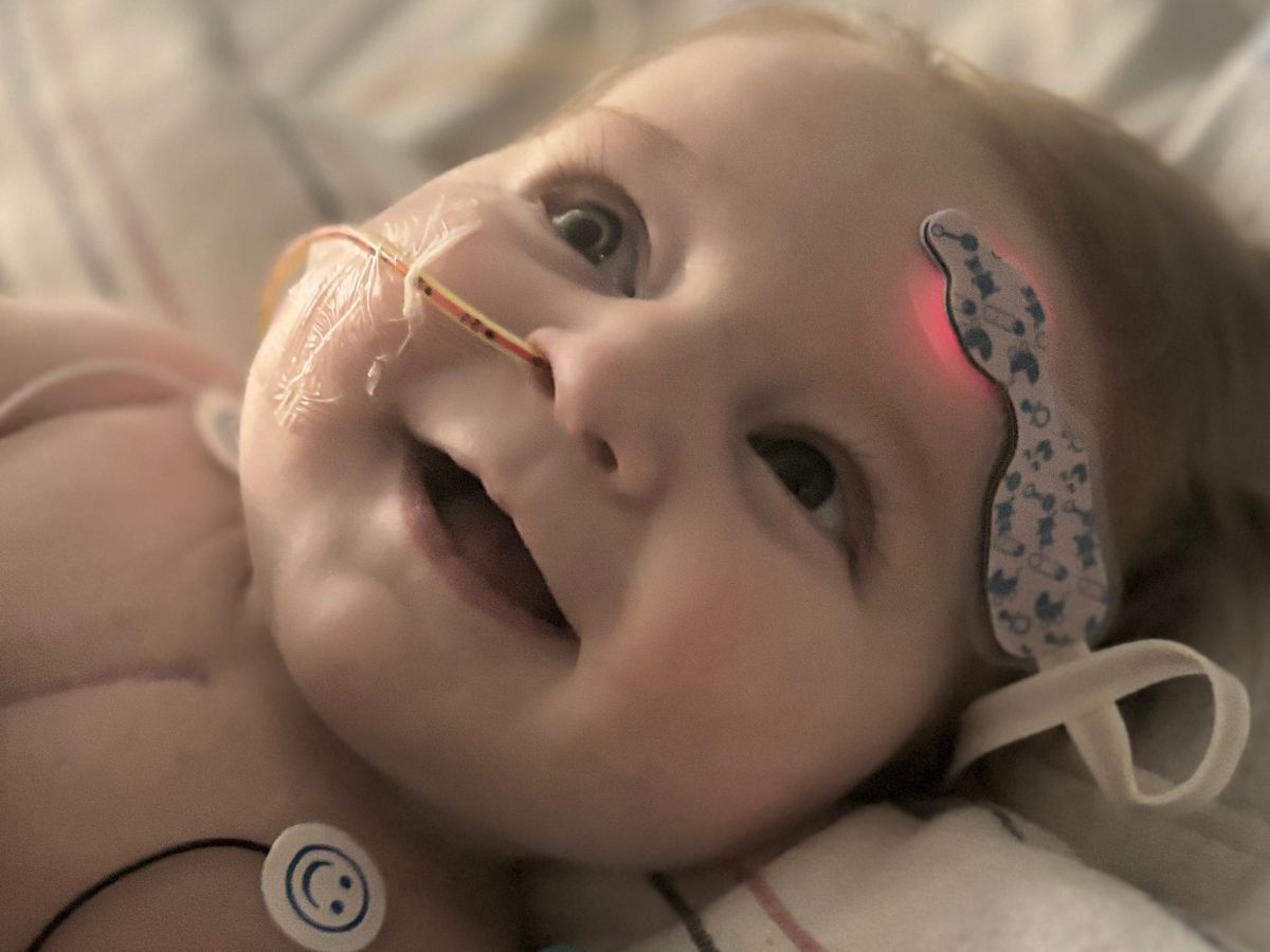 Support Baby Irie on Her Heart Transplant Journey campaign photo, 1 of 3