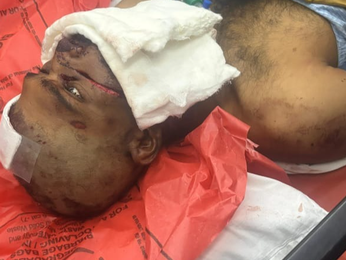 Help a 23-Year-Old Recover After a Devastating Accident, campaign photo, 1 of 5