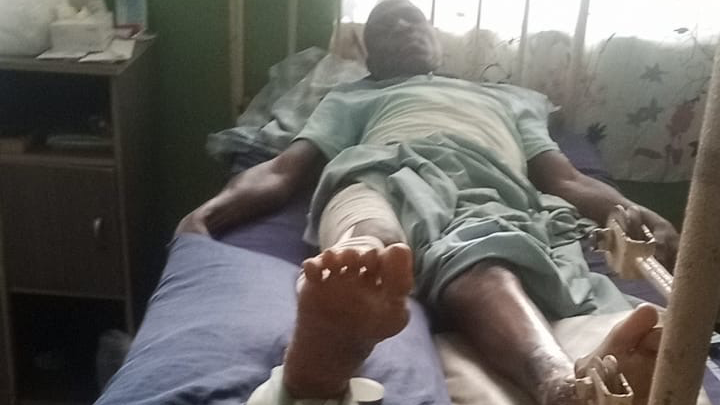 Urgent Total Hip Replacement Surgery-Support Olumuyiwa campaign photo, 1 of 6