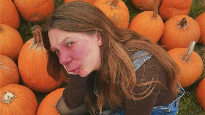 Help Ava Get Life-Changing Treatment campaign photo, 1 of 10
