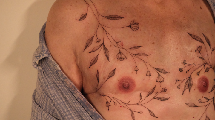 Support Breast Cancer Survivors with the Art of Tattooing campaign photo, 1 of 7
