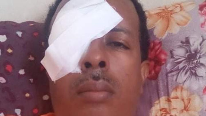 ሓገዝ ንመሓከሚ ዓይኒ ሓውና ብእምነት ሓጎስ ቀላቲ campaign photo, 1 of 2
