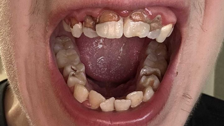 Help me Fix my Teeth campaign photo, 1 of 5